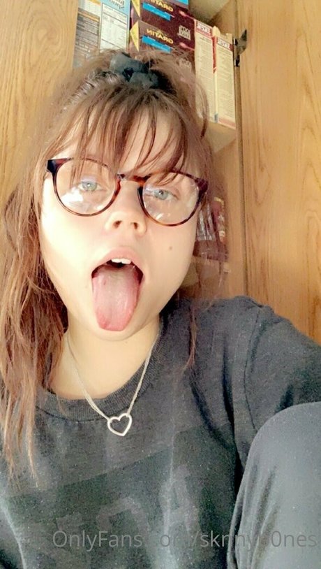 sknnyb0nes top star gallery