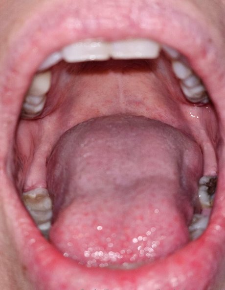 jackdaspeck sexy model photo