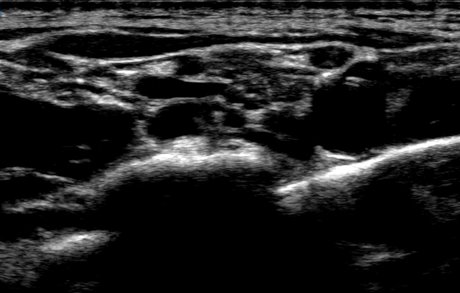 kacenna naked pornstar img