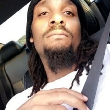 Screw Davis_ model top photo