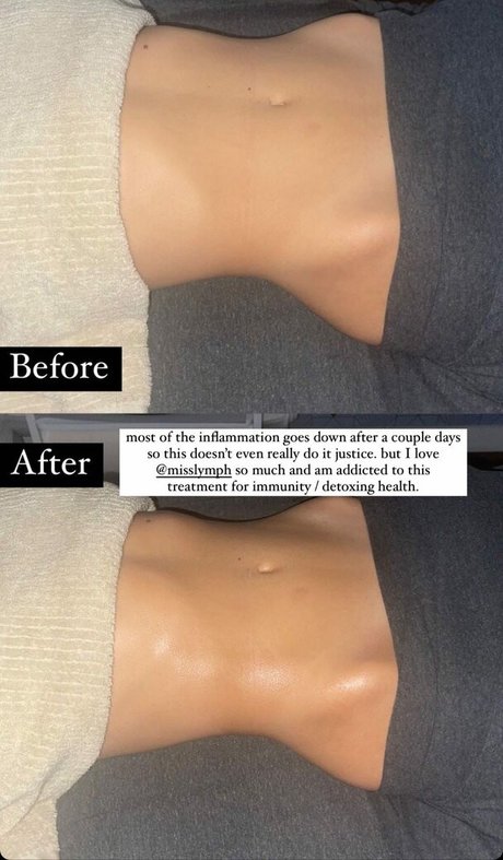 Alyssa Lynch model best picture