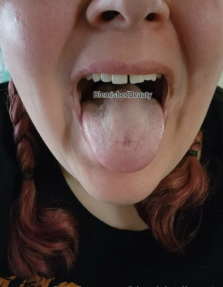 blemishedbeauty model porn image