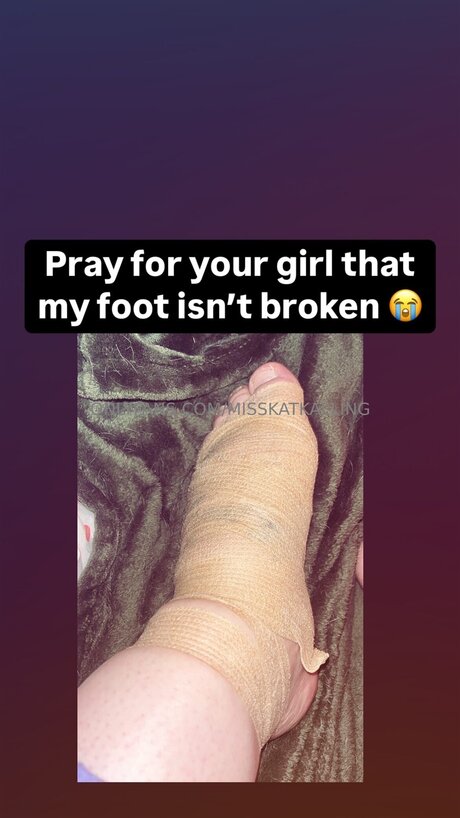 Misskatkalling adult model archive