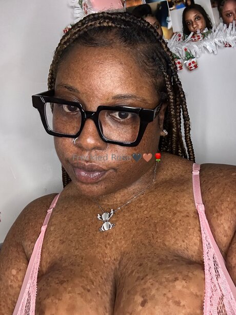 Freckledfantasy5 naked model pictures