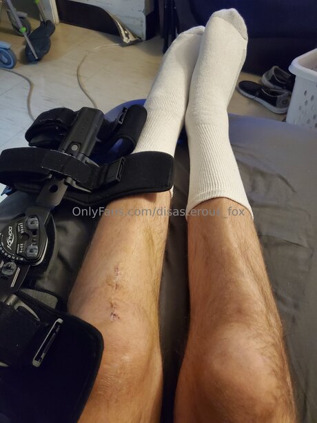 Disasterous Fox model best image