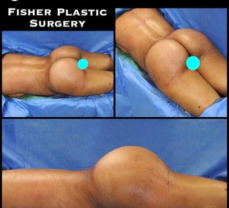 milf tits onlyfans hot xxx images