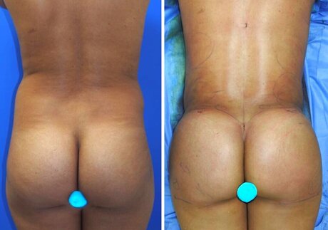 allyiahsface erotic pornstar image