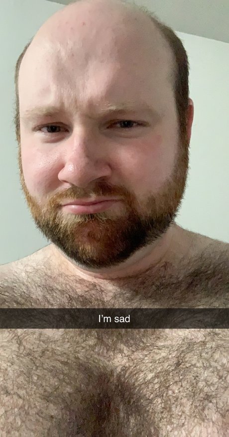 Rlyndrup model adult picture