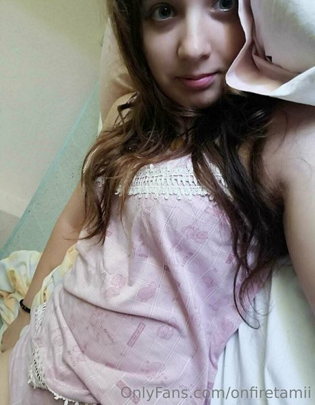 onfiretamii model galleries