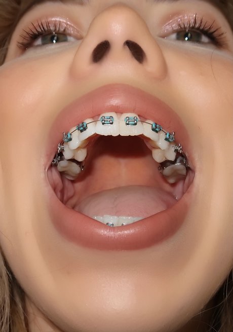 Kate in Braces hot star archive