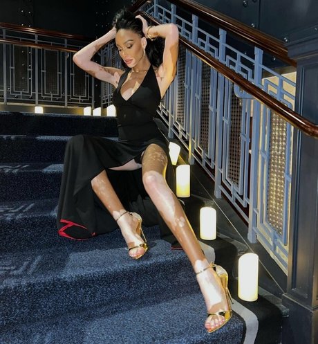 Winnie Harlow hd star photo