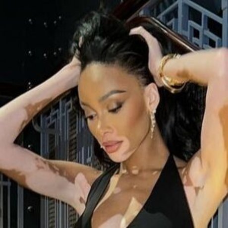 Winnie Harlow pretty actress photo