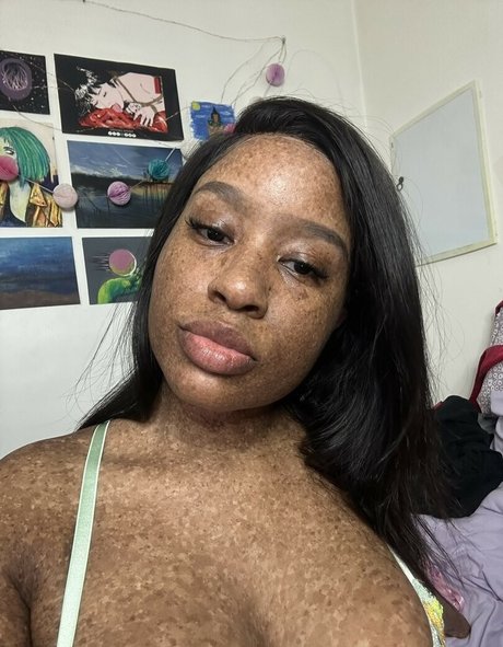 freckledn free model picture