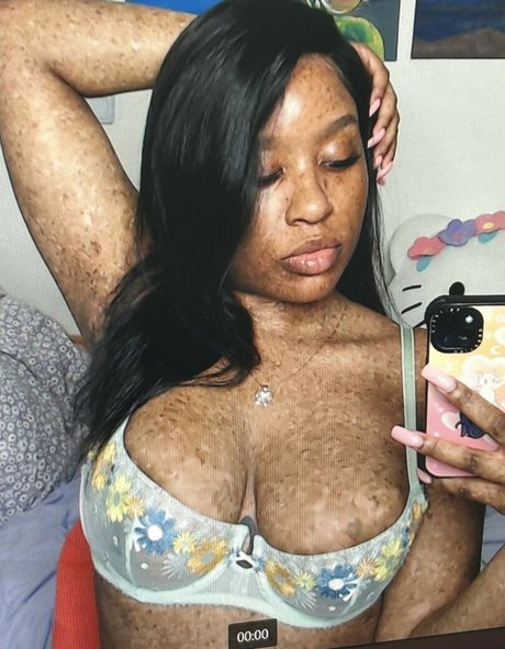 freckledn exclusive actress galleries