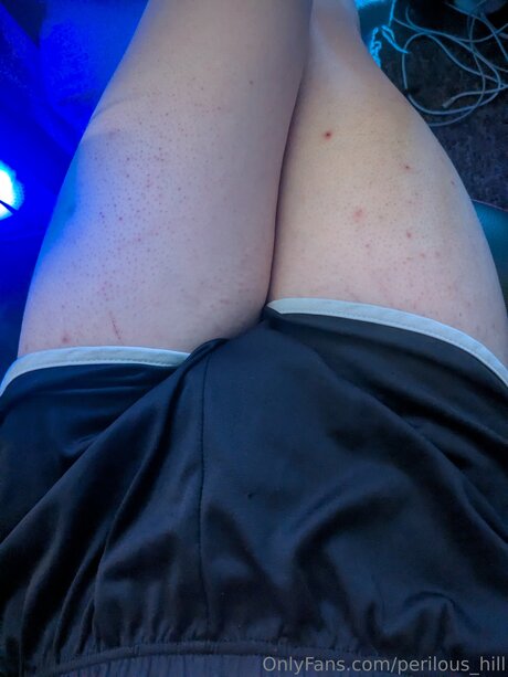 Perilous Hill adult model image