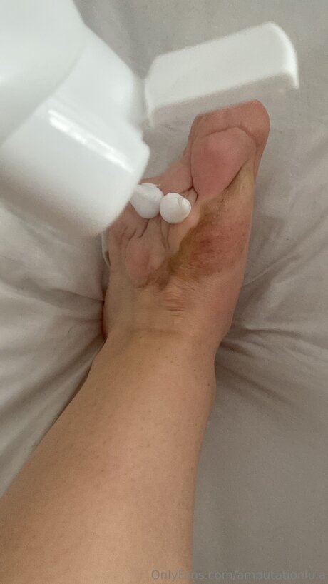 Amputationlula star nudes pic