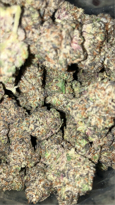 braces onlyfans free nude picture