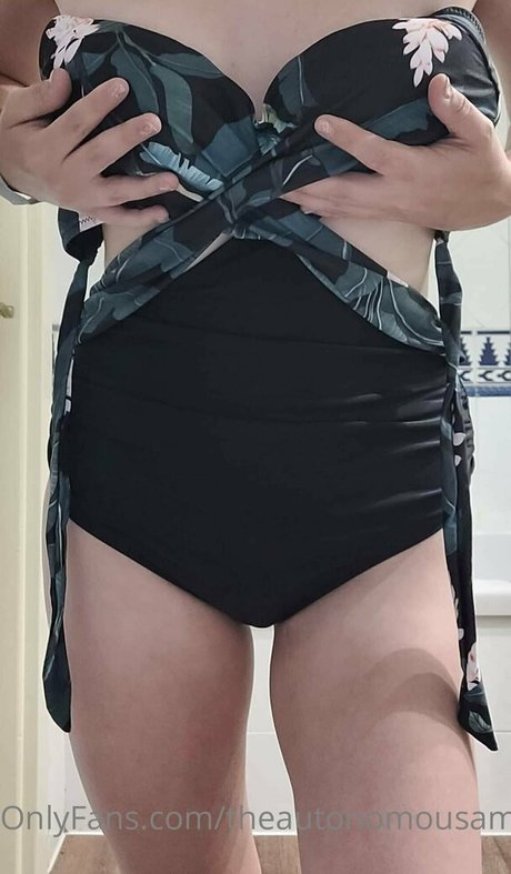 theautonomousamputee2 model sex pictures