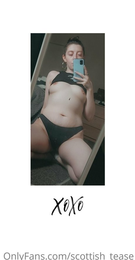 scottish tease star nudes img