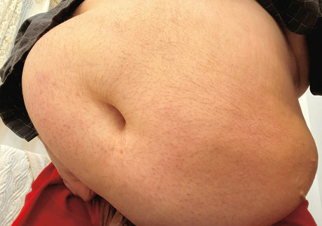 universemanslam model best image