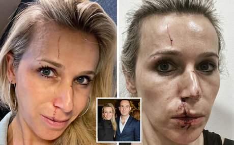 Lara Lewington star nice images