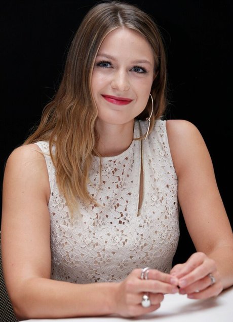 Melissa Benoist star exclusive photo