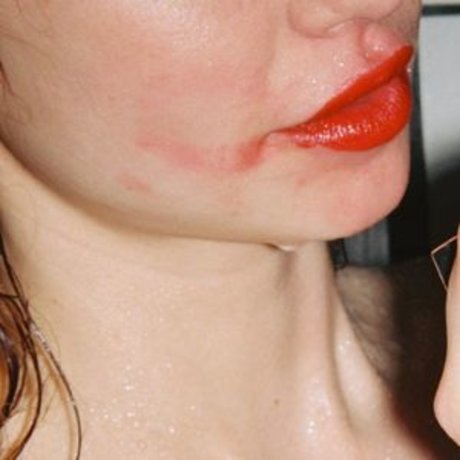 Herbert Twins nudes star pic