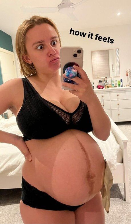 Hannah Witton pornstar sexy photos