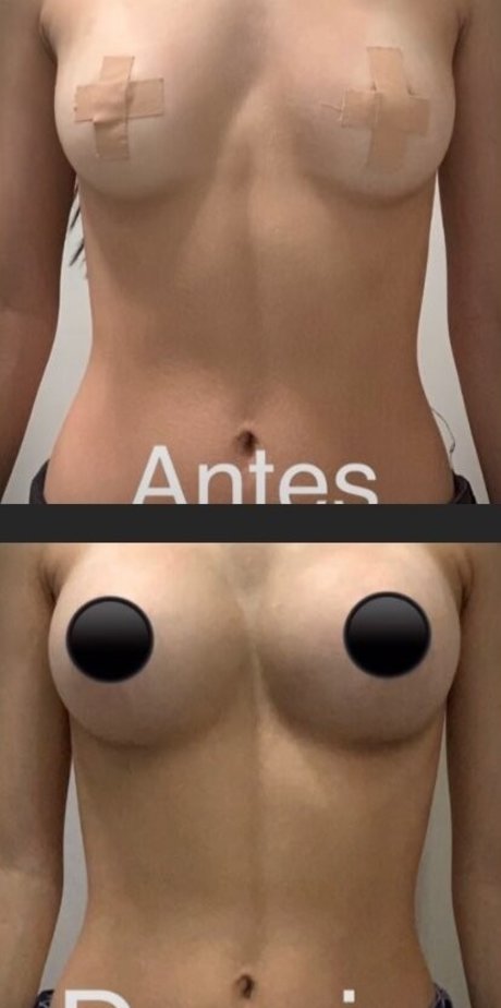 blowjob milf onlyfans nude archive