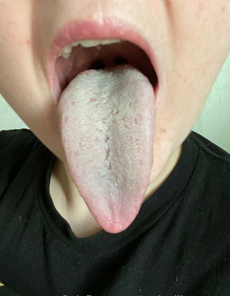 toxicallietongue star hd img