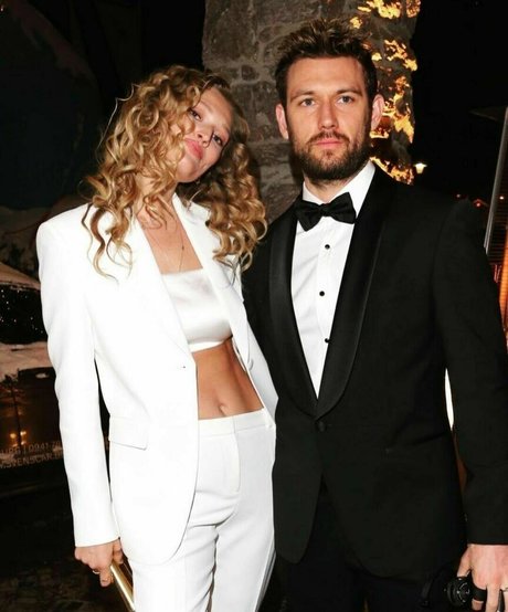 Toni Garrn model nudes photos